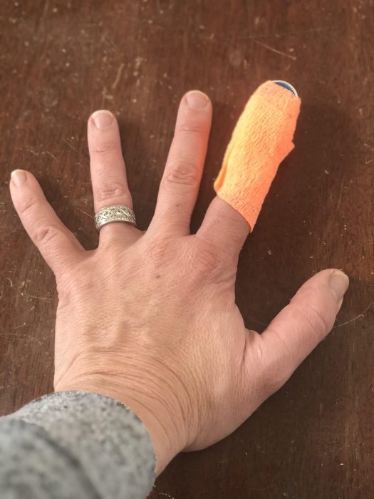An Unexpected Quilting Gift + Slowing Down This Season by popular Utah quilting blog, Diary of a Quilter: image of a bandaged finger.